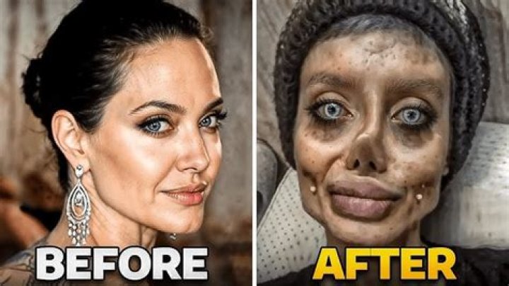 Has Garnacho Undergone Cosmetic Surgery? The Truth Revealed