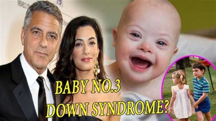 Is Down Syndrome Affecting George Clooney's Twins? - Full Investigation