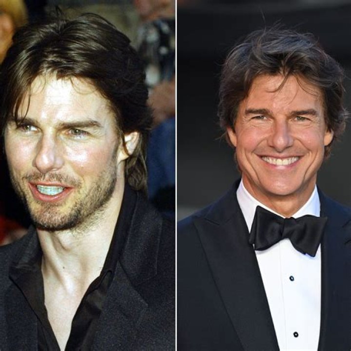Tom Cruise: A Journey Through His Smile Transformation