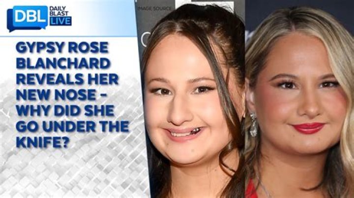 Unraveling The Mystery: How Many Surgeries Did Gypsy Have?