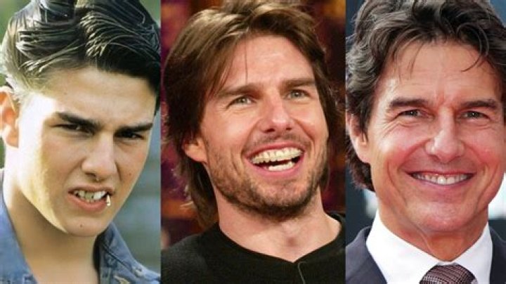 Unveiling The Mystery: Does Tom Cruise Have A Middle Tooth?